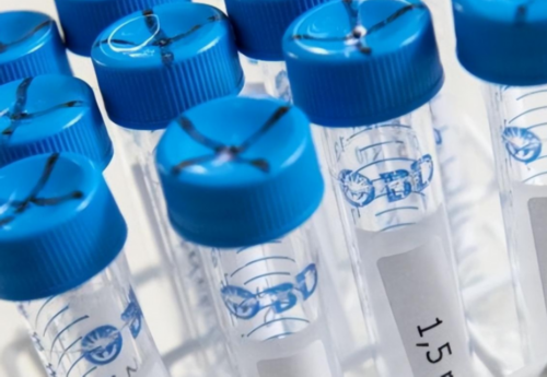 2026中山大学孙逸仙纪念医院供卵试管排队时长揭晓-附费用明细