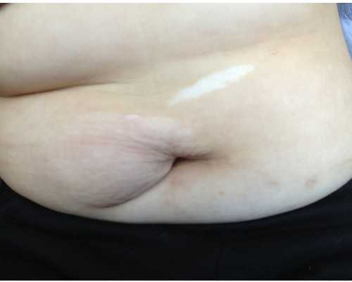 广州试管婴儿价格！附试管医院分享！