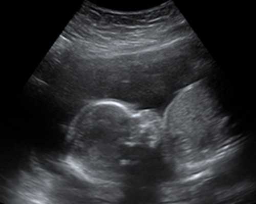 专业代怀包男孩_包性别,海南省人民医院供卵三代试管婴儿单周费用不超过8万元